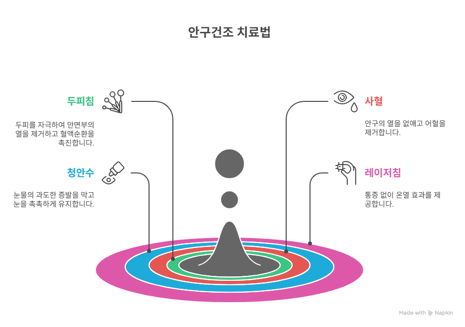소생한의원 안구건조 녹내장 치료