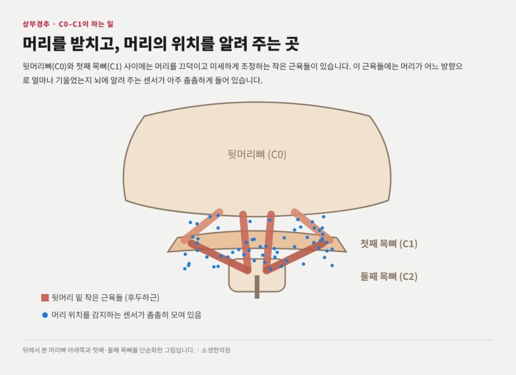 두통 어지러움증 상부경추교정
