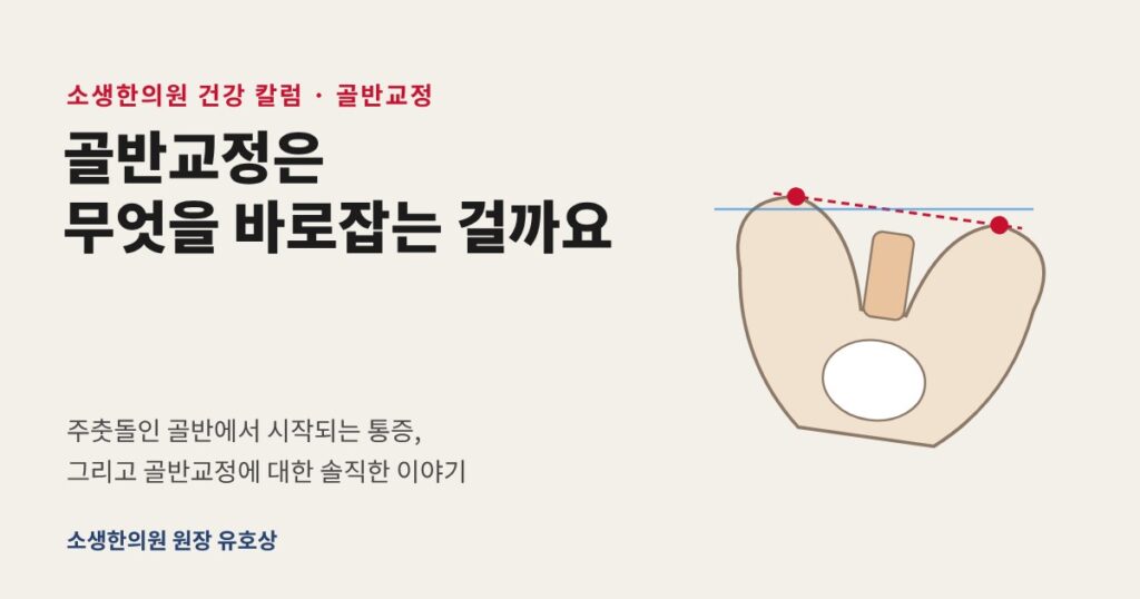 골반틀어짐, 골반교정
