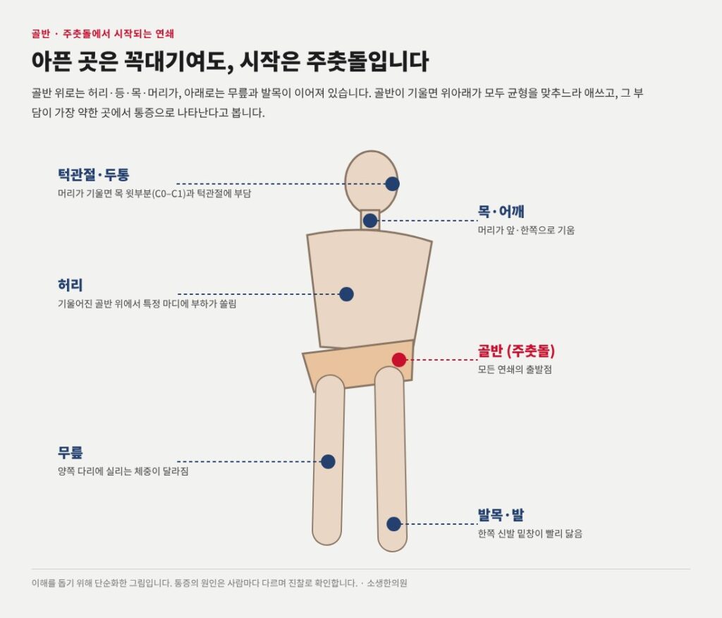 골반틀어짐, 골반교정