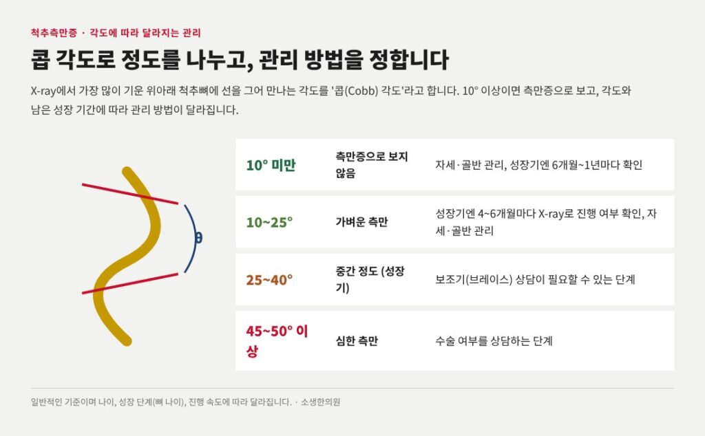 척추측만증 측정