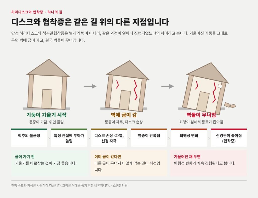 척추관협착증