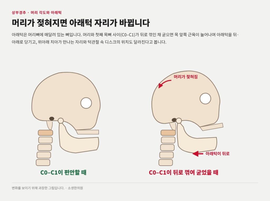 턱관절 장애