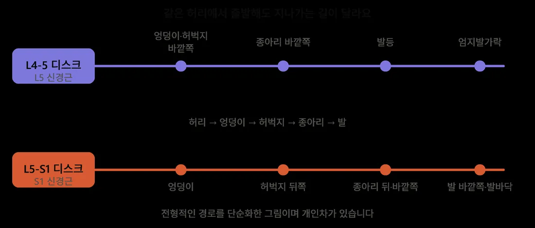 L4-5 디스크와 L5-S1 디스크에서 시작한 신경이 다리로 내려가는 경로 비교