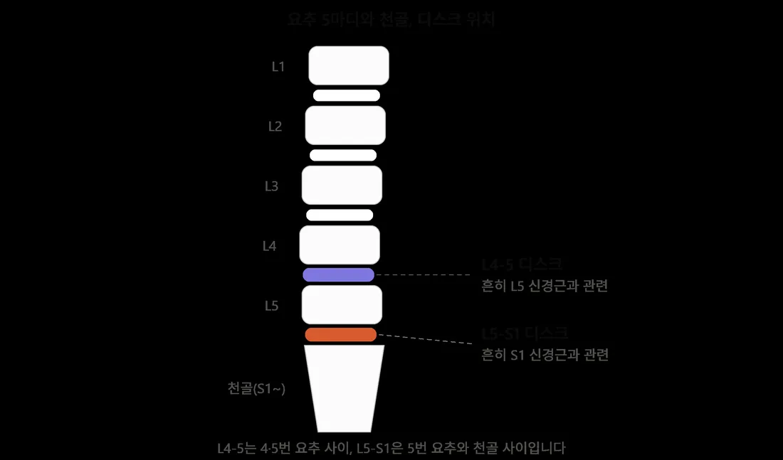 요추 L1~L5와 천골, L4-5·L5-S1 디스크 위치 그림