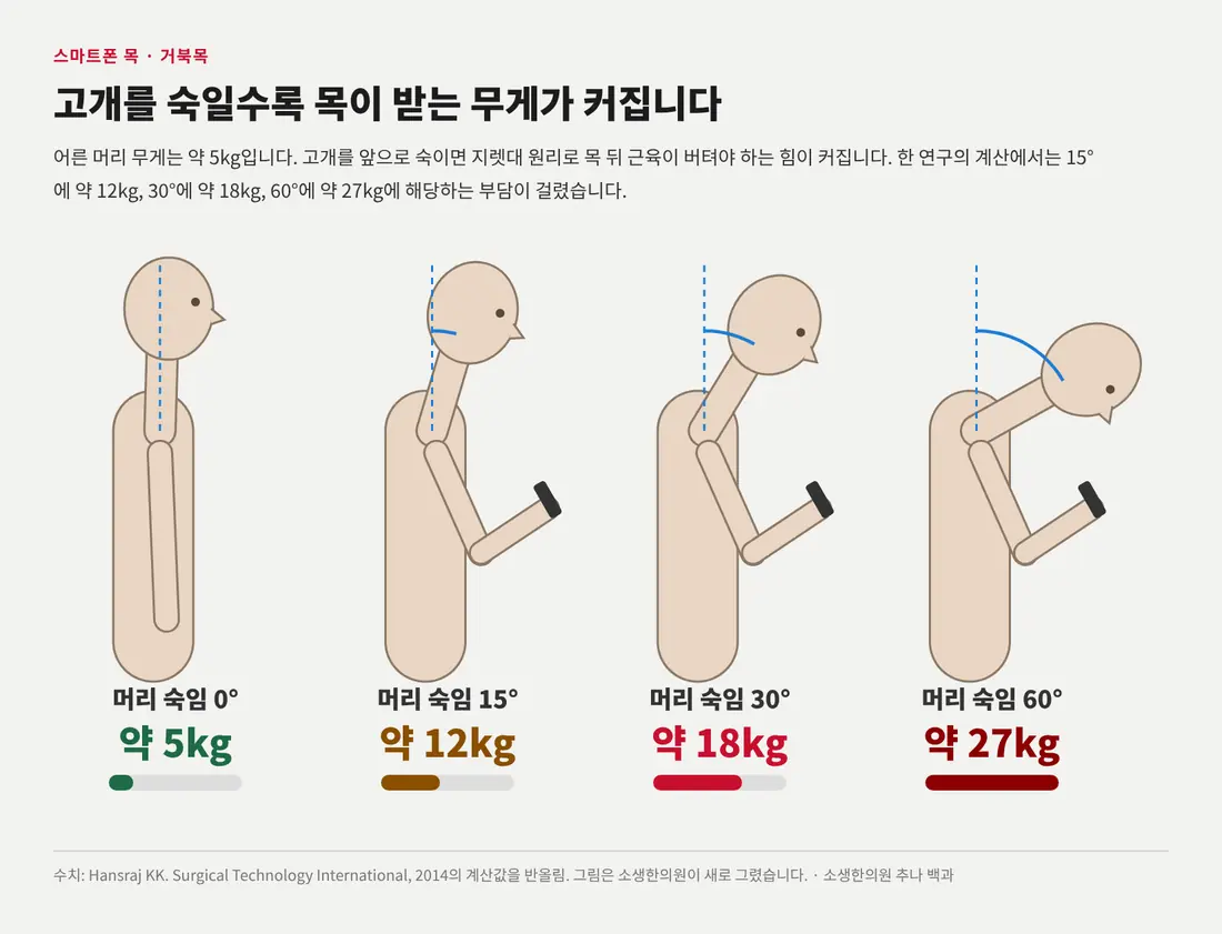 고개 숙임 각도에 따라 목이 받는 부담이 5kg에서 27kg까지 커지는 모습