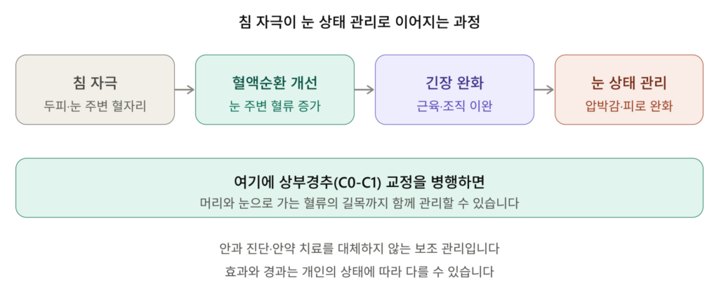 소생한의원 눈침 효과