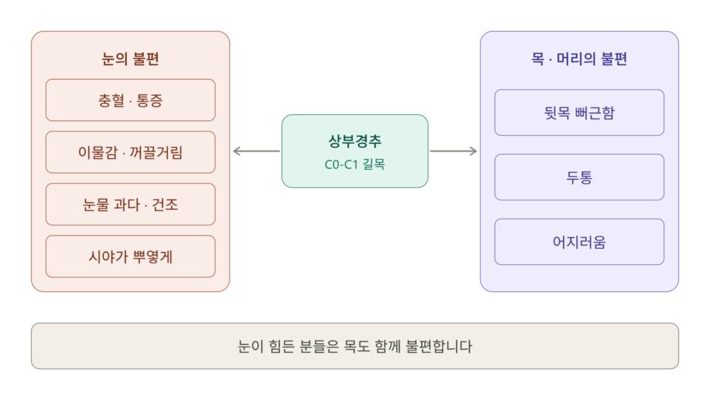 상부경추교정과 녹내장