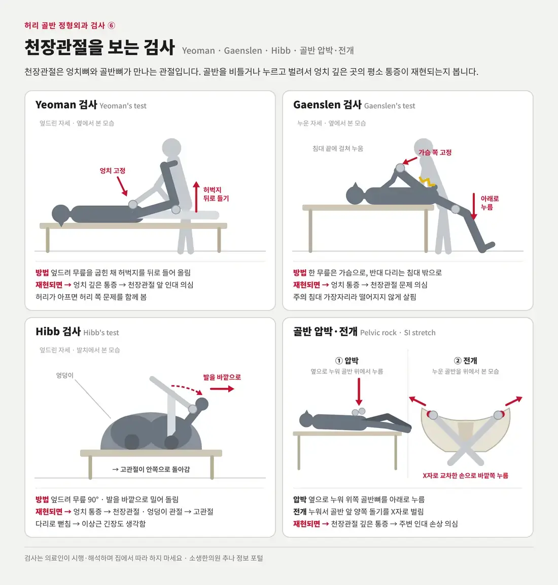 Yeoman, Gaenslen, Hibb 검사와 골반 압박·전개 검사의 자세를 그린 천장관절 검사 도식