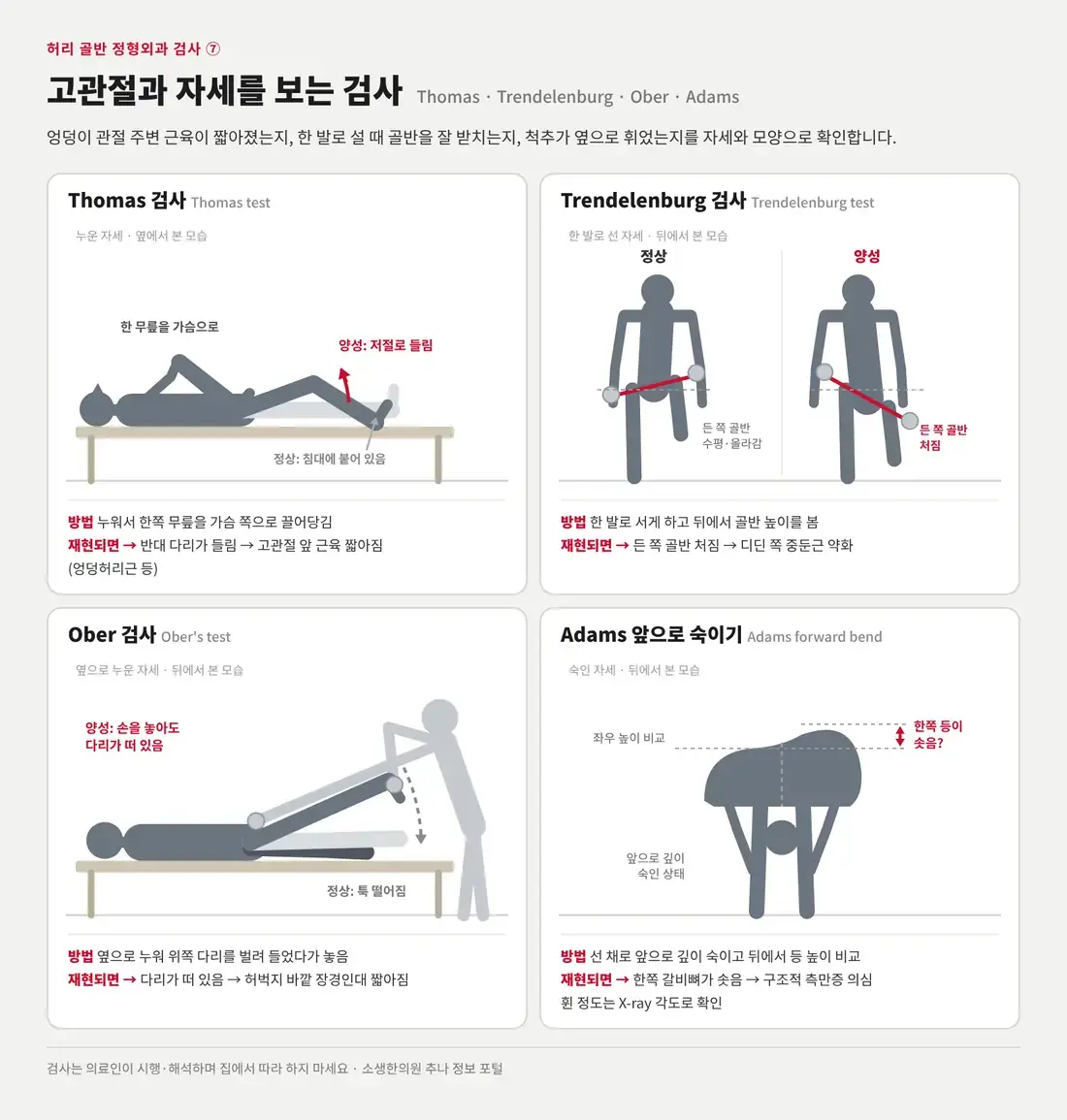 Thomas, Trendelenburg, Ober, Adams 앞으로 숙이기 검사의 자세를 그린 도식