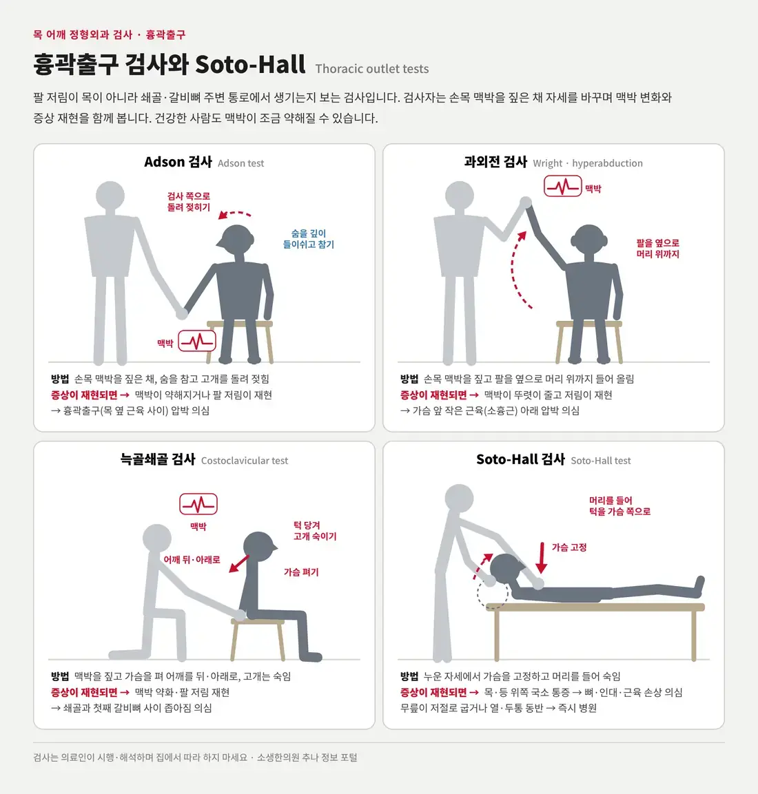 손목 맥박을 짚은 채 고개를 돌려 젖히는 Adson 검사, 팔을 머리 위까지 드는 과외전(Wright) 검사, 가슴을 펴고 어깨를 뒤아래로 당기는 늑골쇄골 검사, 누운 환자의 머리를 들어 숙이는 Soto-Hall 검사를 그린 모식도