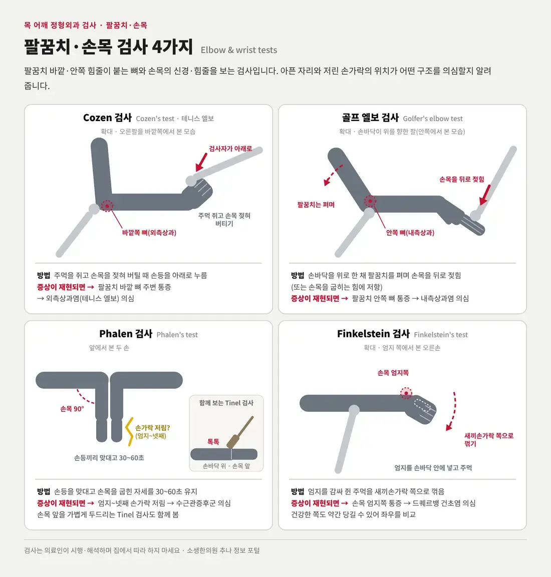 주먹 쥔 손목을 젖혀 버틸 때 손등을 누르는 Cozen 검사, 손바닥을 위로 한 채 손목을 젖히는 골프 엘보 검사, 손등을 맞대고 손목을 굽히는 Phalen 검사와 손목 앞을 두드리는 Tinel 검사, 엄지를 감싼 주먹을 새끼손가락 쪽으로 꺾는 Finkelstein 검사를 그린 모식도